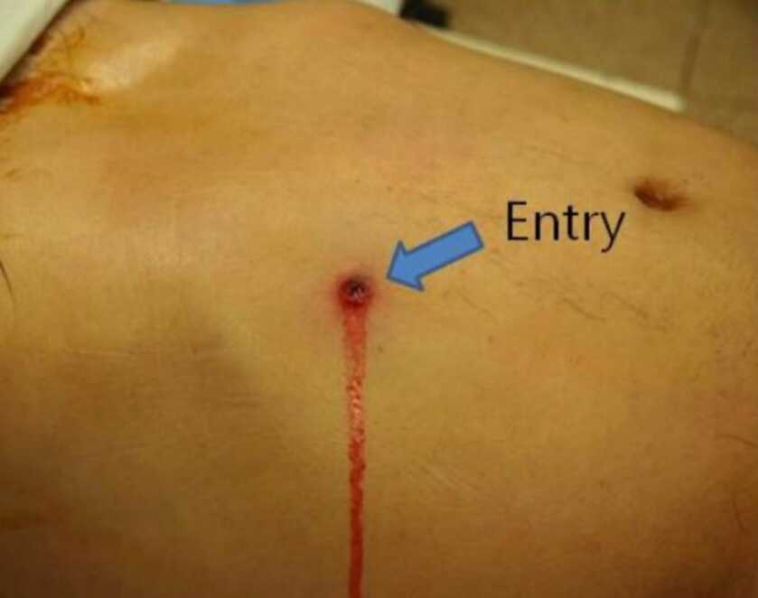 Dr. Dabbs - The .22 Rimfire's Lethality at Work & at Play