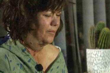 The wounds on Victoria Mendez's neck are visible.  (Photo: AZ Family)