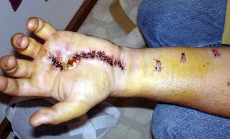 Make sure the gun is unloaded before you disassemble. 