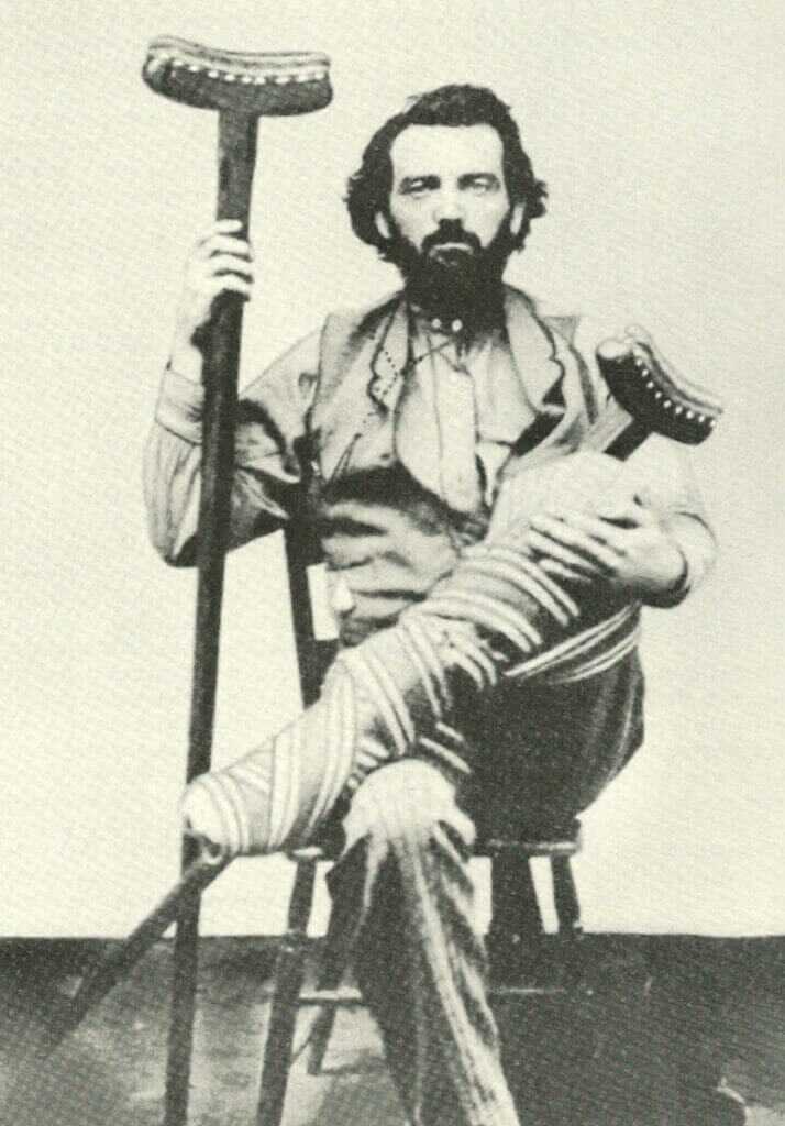 The Life and Times of the Brain-Damaged Gunslinger Clay Allison