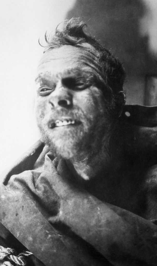 Albert Johnson: The Mad Trapper of Rat River