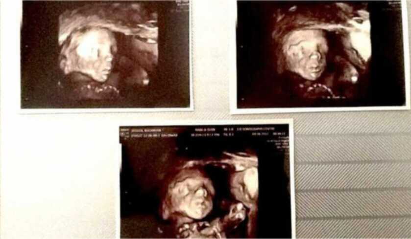 Dr. Dabbs - The Rescue of Jessica Buchanan: That One Perfect Moment Dr. Dabbs - The Rescue of Jessica Buchanan: That One Perfect Moment