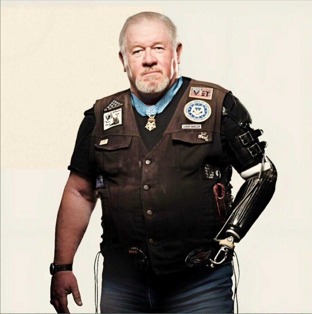 Gary Wetzel after surviving catastrophic wounds during his Vietnam Medal of Honor action