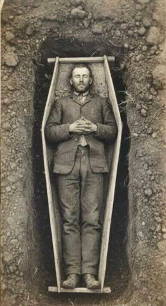 Preserved dead criminal image illustrating the grim roadshow fate of Elmer McCurdy