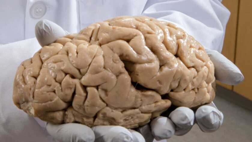 The Life and Times of the Brain-Damaged Gunslinger Clay Allison