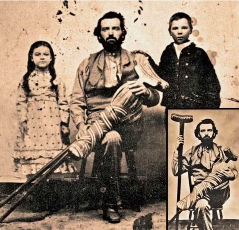 The Life and Times of the Brain-Damaged Gunslinger Clay Allison The Life and Times of the Brain-Damaged Gunslinger Clay Allison