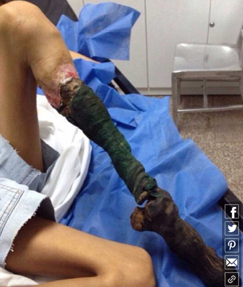 Three Headshots in Ten Minutes: Tangos Down - TacSol X-Ring w/Magpul X-22 Three Headshots in Ten Minutes: Tangos Down - TacSol X-Ring w/Magpul X-22