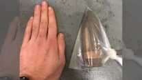 Bomb Squad Called to U.K. Hospital for Patient with Shell Stuck in Behind