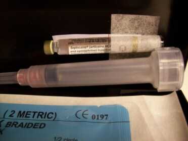 I have seen the small 1.7 ml bottles included with suture kits on Ebay, but they sometimes have epinephrine in them, which is not suggested for inside the mouth. Epi is used to stop bleeding when suturing wounds. 