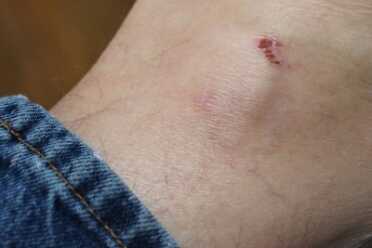 Techna Clip--Deep Concealmeant Clipping in a gun may wear differently than you expect. The P3AT tended to rub on my ankle. Easy enough to fix, though.