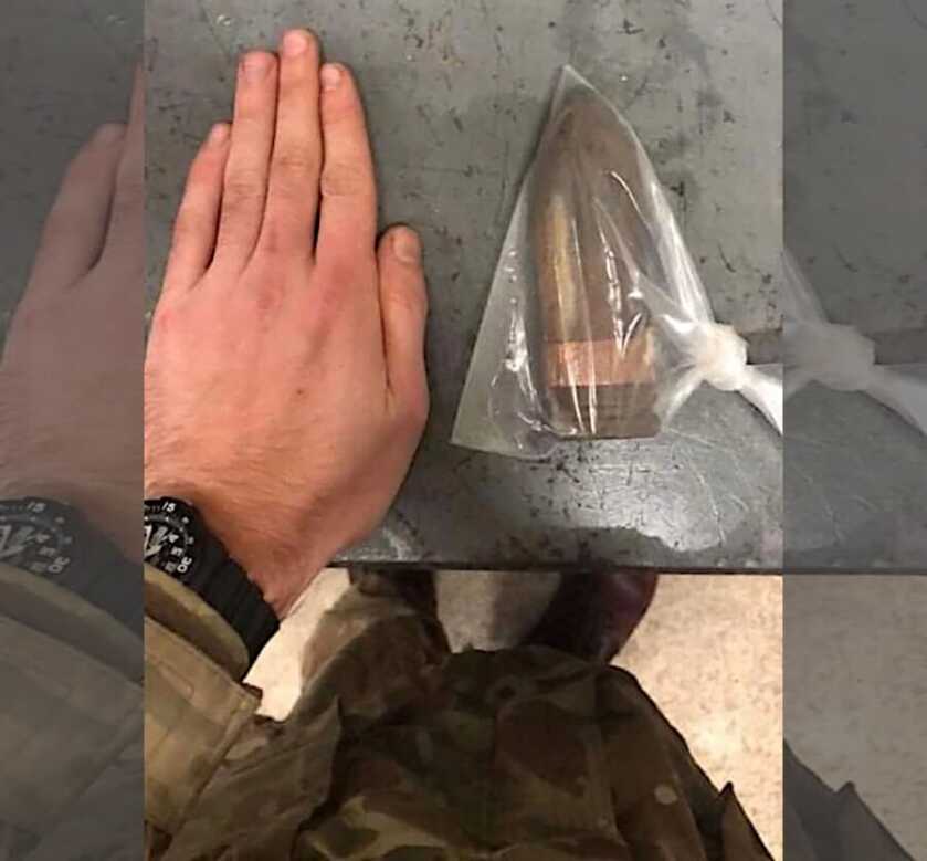 Bomb Squad Called to U.K. Hospital for Patient with Shell Stuck in Behind Bomb Squad Called to U.K. Hospital for Patient with Shell Stuck in Behind