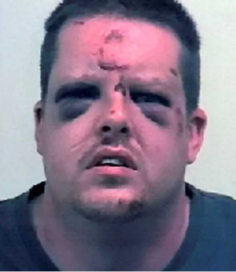 middle aged man with beat up face
